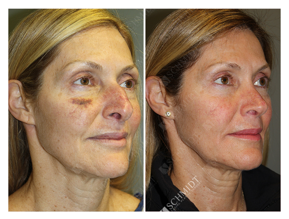 9091 Schmidt Facial Plastic Surgery