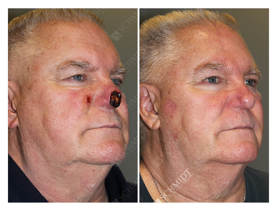 4272 Schmidt Facial Plastic Surgery