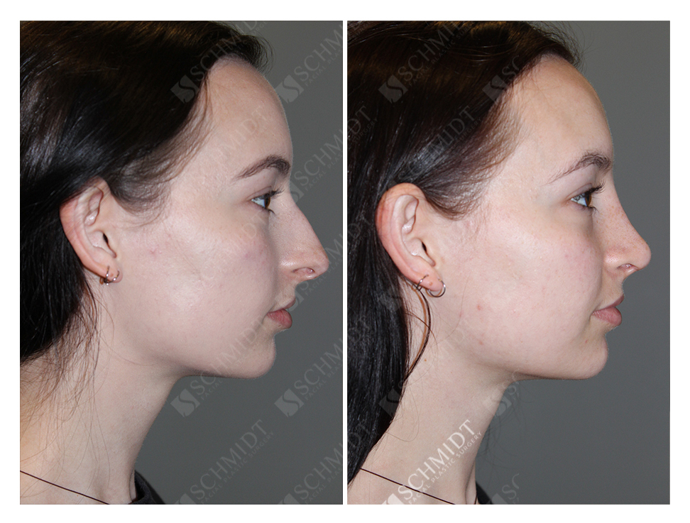 6698 Schmidt Facial Plastic Surgery