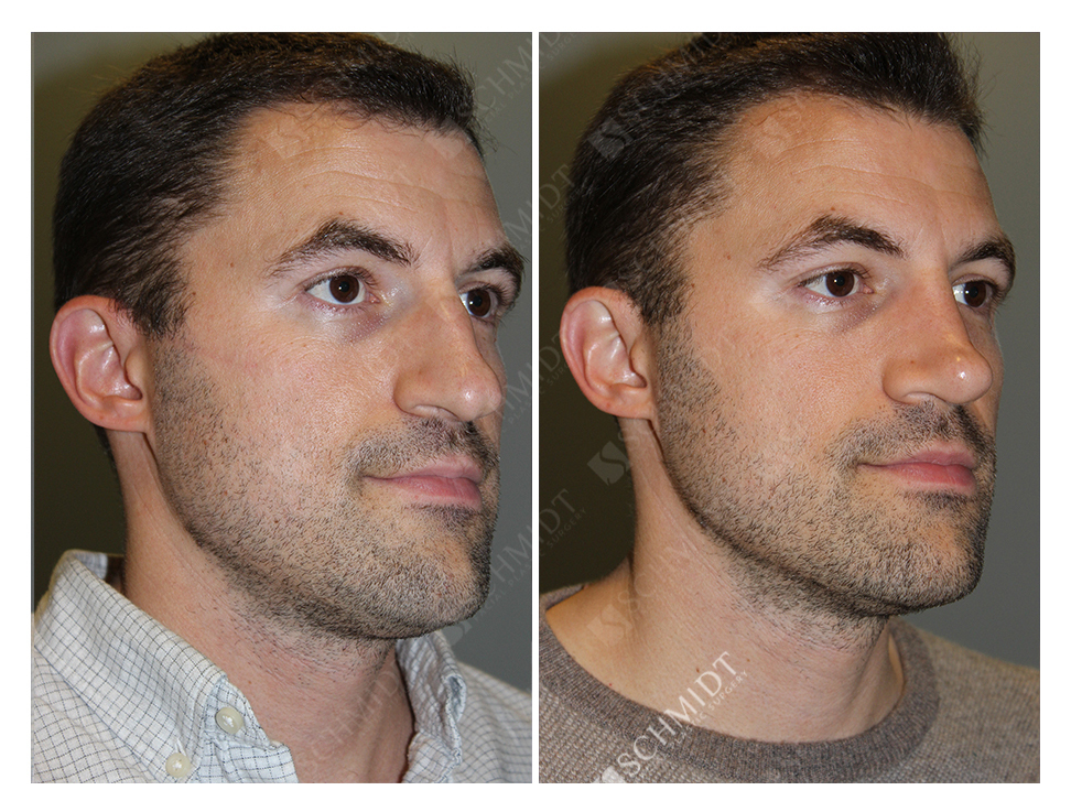 8301 Schmidt Facial Plastic Surgery