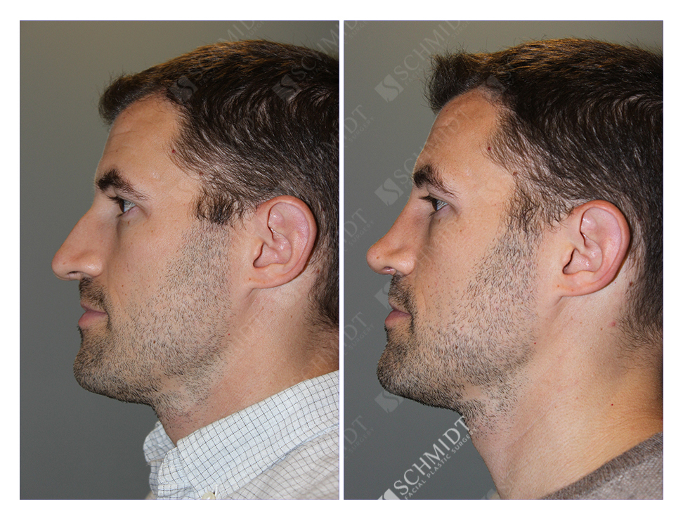 8301 Schmidt Facial Plastic Surgery