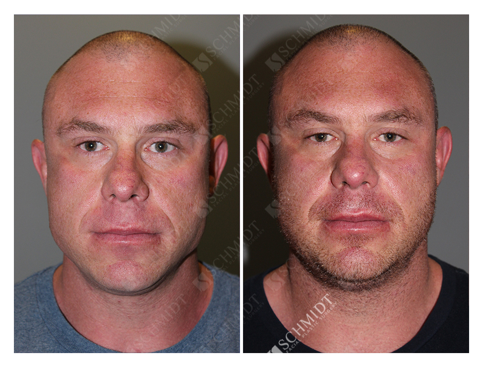 7713 Schmidt Facial Plastic Surgery