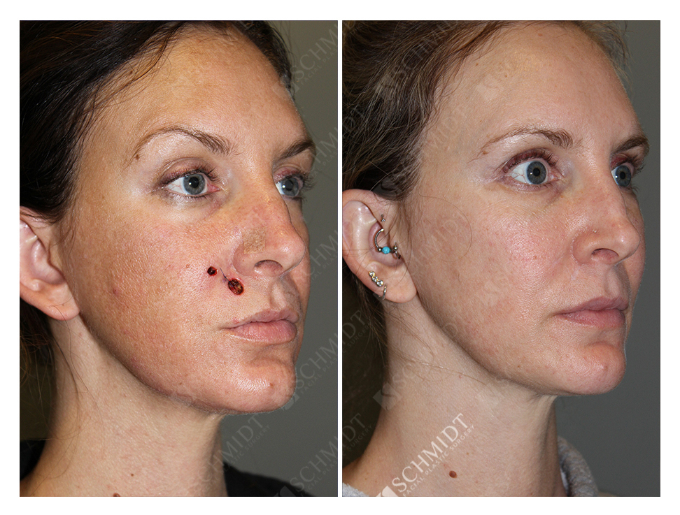 5913 Schmidt Facial Plastic Surgery