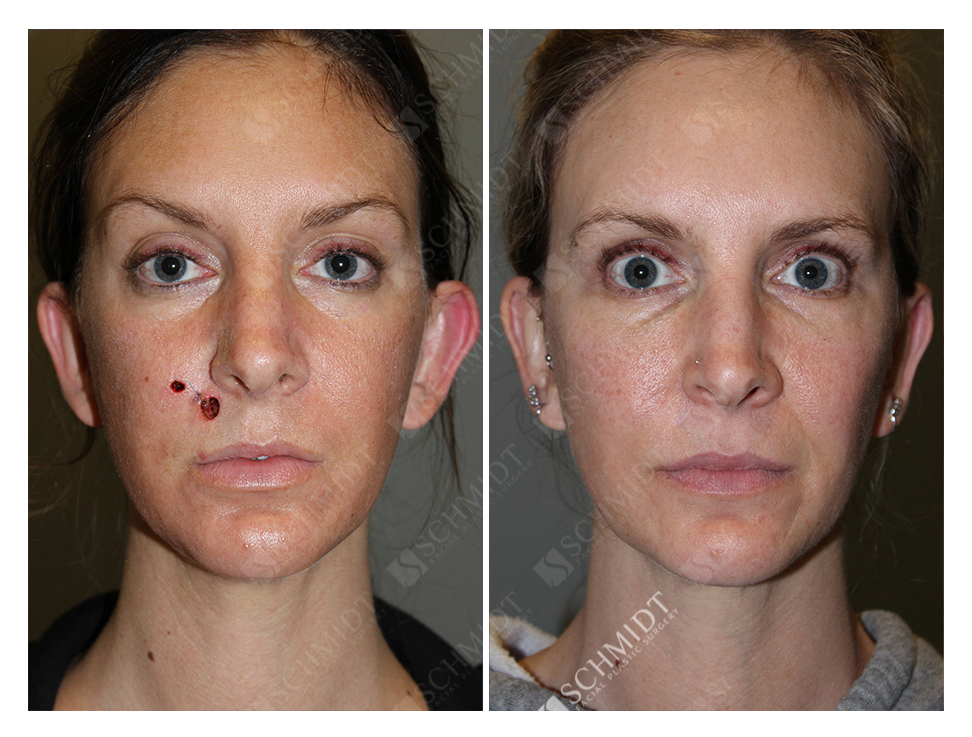 5913 Schmidt Facial Plastic Surgery
