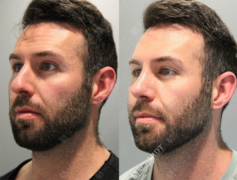 4025 Schmidt Facial Plastic Surgery